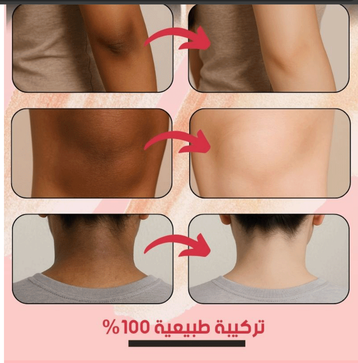 جل التقشير بحمض الخوخ والفواكه من بيواكوا