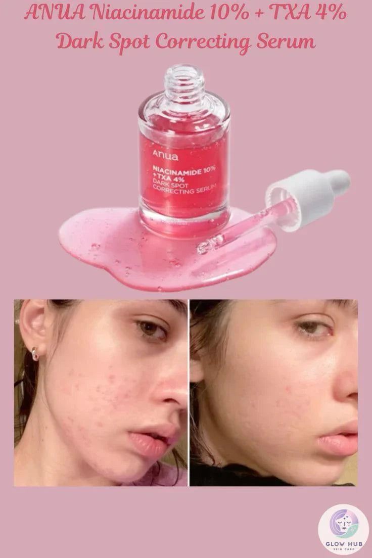 Anua Niacinamide 10% + TXA 4% Serum