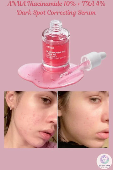 Anua Niacinamide 10% + TXA 4% Serum